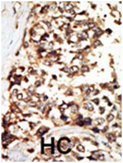 PKD2 Rabbit anti-Human, Polyclonal Antibody, Abnova 400&mu;L; Unlabeled:Antibodies,