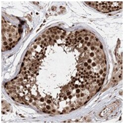 TEX15, Rabbit, Polyclonal Antibody, Abnova 100&mu;L; Unlabeled:Antibodies,