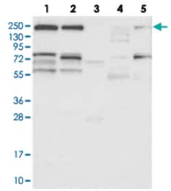 NCAN, Rabbit, Polyclonal Antibody, Abnova 100&mu;L; Unlabeled:Antibodies,