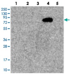 TATDN2, Rabbit, Polyclonal Antibody, Abnova 100 &mu;L | Buy Online | Abnova Corporation | Fisher Scientific