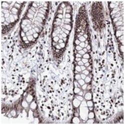 TATDN2, Rabbit, Polyclonal Antibody, Abnova 100 &mu;L | Buy Online | Abnova Corporation | Fisher Scientific