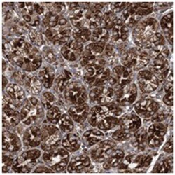 NGLY1, Rabbit, Polyclonal Antibody, Abnova 100&mu;L; Unlabeled:Antibodies,