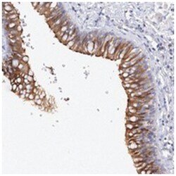 TAMM41, Rabbit, Polyclonal Antibody, Abnova 100 &mu;L | Buy Online | Abnova Corporation | Fisher Scientific