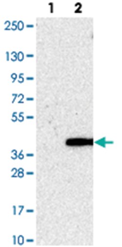 TAMM41, Rabbit, Polyclonal Antibody, Abnova 100 &mu;L | Buy Online | Abnova Corporation | Fisher Scientific