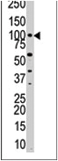 PKN3, Rabbit, Polyclonal Antibody, Abnova 400 &mu;L | Buy Online | Abnova Corporation | Fisher Scientific