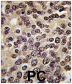 PKN3, Rabbit, Polyclonal Antibody, Abnova 400 &mu;L | Buy Online | Abnova Corporation | Fisher Scientific