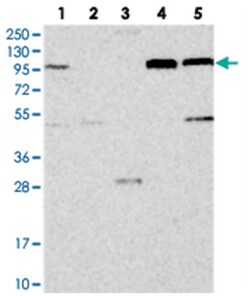 COPB2, Rabbit, Polyclonal Antibody, Abnova 100&mu;L; Unlabeled:Antibodies,