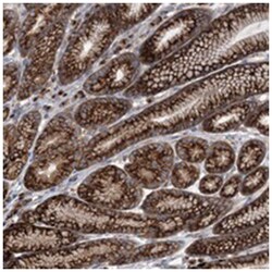 COPB2, Rabbit, Polyclonal Antibody, Abnova 100&mu;L; Unlabeled:Antibodies,