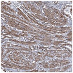 CWF19L1 Rabbit anti-Human, Mouse, Polyclonal Antibody, Abnova 100 &mu;L | Buy Online | Abnova Corporation | Fisher Scientific