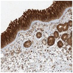 KIAA0232, Rabbit, Polyclonal Antibody, Abnova 100 &mu;L | Buy Online | Abnova Corporation | Fisher Scientific
