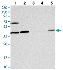COPS4, Rabbit, Polyclonal Antibody, Abnova 100 &mu;L | Buy Online | Abnova Corporation | Fisher Scientific