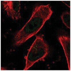 COPS4, Rabbit, Polyclonal Antibody, Abnova 100 &mu;L | Buy Online | Abnova Corporation | Fisher Scientific