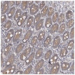 ZC3H12D Rabbit anti-Human, Polyclonal Antibody, Abnova 100&mu;L; Unlabeled:Antibodies,