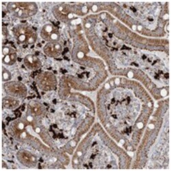 SLC22A16, Rabbit, Polyclonal Antibody, Abnova 100 &mu;L | Buy Online | Abnova Corporation | Fisher Scientific