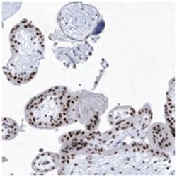 DCLRE1A, Rabbit, Polyclonal Antibody, Abnova 100&mu;L; Unlabeled:Antibodies,