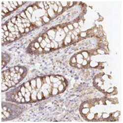 TBC1D14, Rabbit, Polyclonal Antibody, Abnova 100 &mu;L | Buy Online | Abnova Corporation | Fisher Scientific