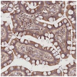 CEP70 Rabbit anti-Human, Polyclonal Antibody, Abnova 100 &mu;L | Buy Online | Abnova Corporation | Fisher Scientific