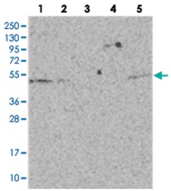 CEP70 Rabbit anti-Human, Polyclonal Antibody, Abnova 100&mu;L; Unlabeled:Antibodies,