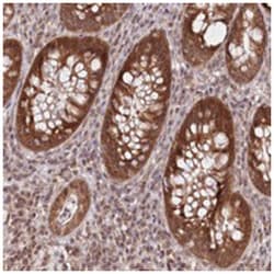 CEP70 Rabbit anti-Human, Polyclonal Antibody, Abnova 100&mu;L; Unlabeled:Antibodies,