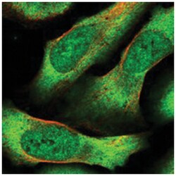 CEP70 Rabbit anti-Human, Polyclonal Antibody, Abnova 100&mu;L; Unlabeled:Antibodies,