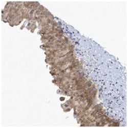SRGAP3, Rabbit, Polyclonal Antibody, Abnova 100 &mu;L | Buy Online | Abnova Corporation | Fisher Scientific