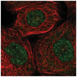 RNF7 Rabbit anti-Human, Polyclonal Antibody, Abnova 100&mu;L; Unlabeled:Antibodies,