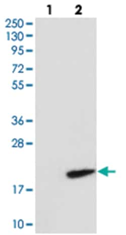 RNF7 Rabbit anti-Human, Polyclonal Antibody, Abnova 100&mu;L; Unlabeled:Antibodies,