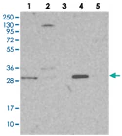 NIT2, Rabbit, Polyclonal Antibody, Abnova 100 &mu;L | Buy Online | Abnova Corporation | Fisher Scientific