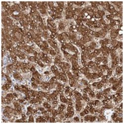 NIT2, Rabbit, Polyclonal Antibody, Abnova 100 &mu;L | Buy Online | Abnova Corporation | Fisher Scientific