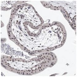 FAM44A, Rabbit, Polyclonal Antibody, Abnova 100&mu;L; Unlabeled:Antibodies,