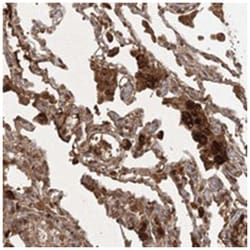 ARL13A, Rabbit, Polyclonal Antibody, Abnova 100 &mu;L | Buy Online | Abnova | Fisher Scientific
