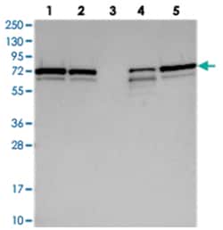 SNX2, Rabbit, Polyclonal Antibody, Abnova 100&mu;L; Unlabeled:Antibodies,