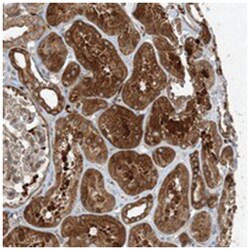 SNX2, Rabbit, Polyclonal Antibody, Abnova 100&mu;L; Unlabeled:Antibodies,