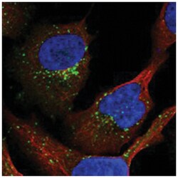 SNX2, Rabbit, Polyclonal Antibody, Abnova 100&mu;L; Unlabeled:Antibodies,