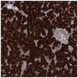 SHE, Rabbit, Polyclonal Antibody, Abnova 100&mu;L; Unlabeled:Antibodies,