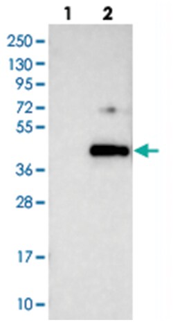 C1orf56, Rabbit, Polyclonal Antibody, Abnova 100 &mu;L | Buy Online | Abnova Corporation | Fisher Scientific
