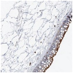 DNAH5 Rabbit anti-Human, Polyclonal Antibody, Abnova 100μL; Unlabeled:Antibodies,