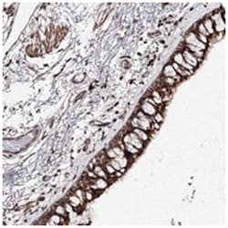 RANBP3L, Rabbit, Polyclonal Antibody, Abnova 100 &mu;L | Buy Online | Abnova Corporation | Fisher Scientific