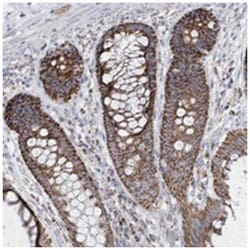 TMCO6 Rabbit anti-Human, Polyclonal Antibody, Abnova 100 &mu;L | Buy Online | Abnova Corporation | Fisher Scientific