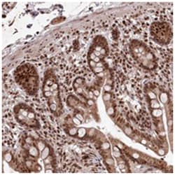 KIAA1128 Rabbit anti-Human, Polyclonal Antibody, Abnova 100&mu;L; Unlabeled:Antibodies,