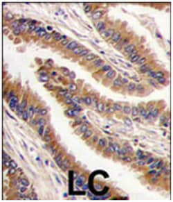 PRKX, Rabbit, Polyclonal Antibody, Abnova 400&mu;L; Unlabeled:Antibodies,
