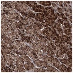 KIAA1128 Rabbit anti-Human, Mouse, Rat, Polyclonal Antibody, Abnova 100&mu;L;