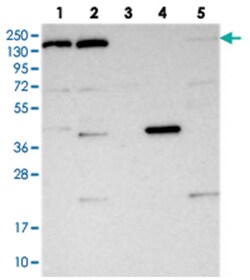 POLR2B, Rabbit, Polyclonal Antibody, Abnova 100 &mu;L | Buy Online | Abnova Corporation | Fisher Scientific