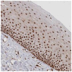 POLR2B, Rabbit, Polyclonal Antibody, Abnova 100 &mu;L | Buy Online | Abnova Corporation | Fisher Scientific