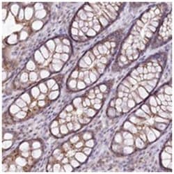 ZFYVE27, Rabbit, Polyclonal Antibody, Abnova 100 &mu;L | Buy Online | Abnova Corporation | Fisher Scientific