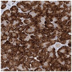 MMADHC Rabbit anti-Human, Polyclonal Antibody, Abnova 100&mu;L; Unlabeled:Antibodies,