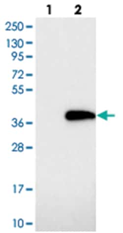 MMADHC Rabbit anti-Human, Polyclonal Antibody, Abnova 100&mu;L; Unlabeled:Antibodies,