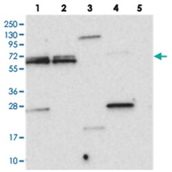 SPAG16, Rabbit, Polyclonal Antibody, Abnova 100 &mu;L | Buy Online | Abnova Corporation | Fisher Scientific