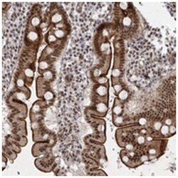 SR140, Rabbit, Polyclonal Antibody, Abnova 100 &mu;L | Buy Online | Abnova Corporation | Fisher Scientific