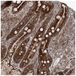 MRPL47 Rabbit anti-Human, Polyclonal Antibody, Abnova 100&mu;L; Unlabeled:Antibodies,